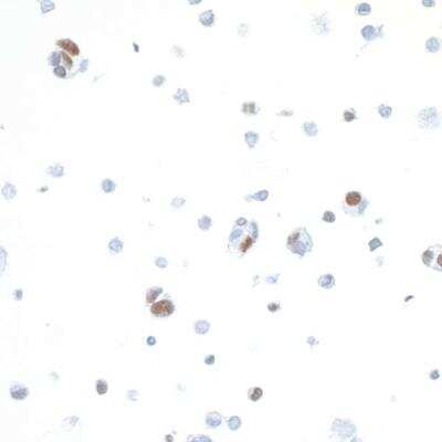 Immunocytochemistry: IRF1 Antibody (BLR039F) [NBP2-76419]