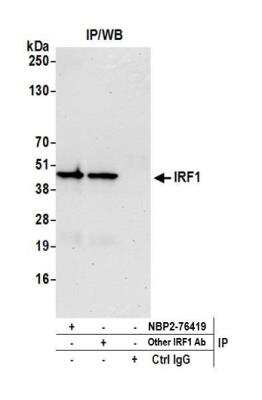 Immunoprecipitation: IRF1 Antibody (BLR039F) [NBP2-76419]