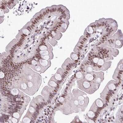 Immunohistochemistry-Paraffin: IRF1 Antibody [NBP2-49384]