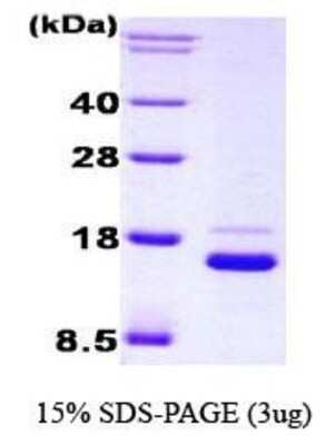 SDS-PAGE: Recombinant Human IRF1 His Protein [NBC1-18471]