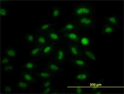 Immunocytochemistry/ Immunofluorescence: IRF2 Antibody (3D6) [H00003660-M01]