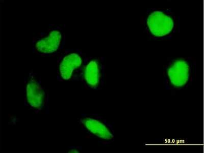 Immunocytochemistry/ Immunofluorescence: IRF2 Antibody (7C2) [H00003660-M04]