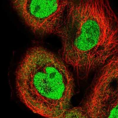 Immunocytochemistry/ Immunofluorescence: IRF2 Antibody [NBP2-56712]
