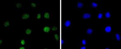Immunocytochemistry/ Immunofluorescence: IRF2 Antibody (JJ088-0) [NBP2-67870]