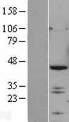 Western Blot: IRF2 Overexpression Lysate [NBL1-12031]