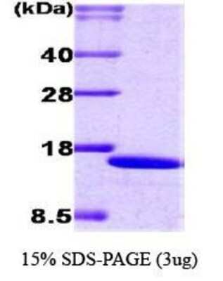 SDS-PAGE: Recombinant Human IRF2 His Protein [NBC1-18476]