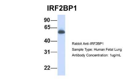 Western Blot: IRF2BP1 Antibody [NBP1-55309]