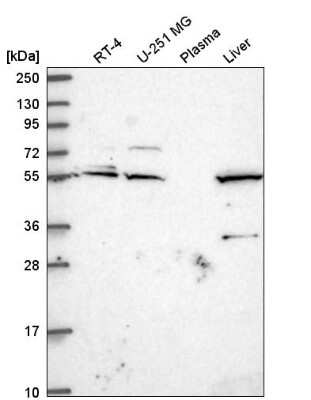 Western Blot: IRF2BP1 Antibody [NBP2-58542]