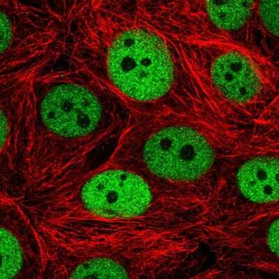 Immunocytochemistry/ Immunofluorescence: IRF2BPL Antibody [NBP2-14712]