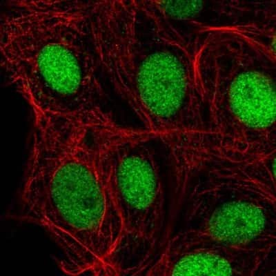 Immunocytochemistry/ Immunofluorescence: IRF2BPL Antibody [NBP2-56241]