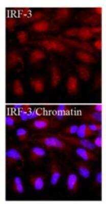 Immunocytochemistry/ Immunofluorescence: IRF3 Antibody (3F10) - BSA Free [NBP1-04308]