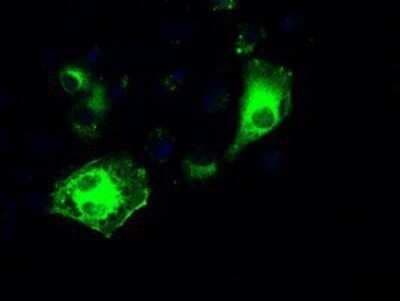 Immunocytochemistry/ Immunofluorescence: IRF3 Antibody (OTI2G3) - Azide and BSA Free [NBP2-71042]