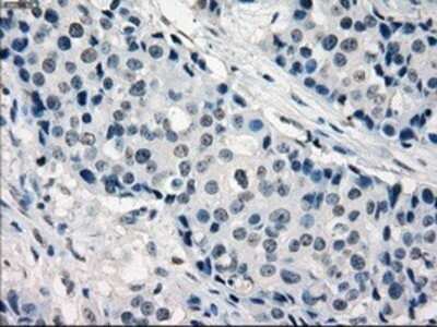 Immunohistochemistry: IRF3 Antibody (OTI2G3) - Azide and BSA Free [NBP2-71042]