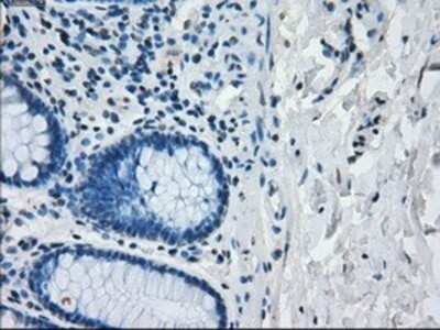 Immunohistochemistry: IRF3 Antibody (OTI2G3) - Azide and BSA Free [NBP2-71042]
