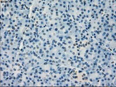 Immunohistochemistry: IRF3 Antibody (OTI2G3) - Azide and BSA Free [NBP2-71042]