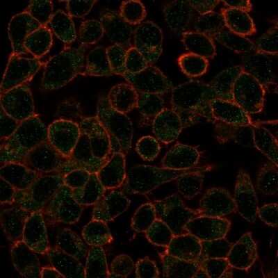 Immunocytochemistry/ Immunofluorescence: IRF3 Antibody (PCRP-IRF3-1E6) [NBP3-07529]