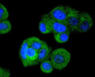 Immunocytochemistry/ Immunofluorescence: IRF3 Antibody (SD2062) [NBP2-67741]