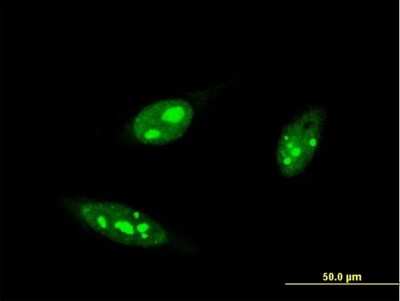 Immunocytochemistry/ Immunofluorescence: IRF4 Antibody (2D1) [H00003662-M05]