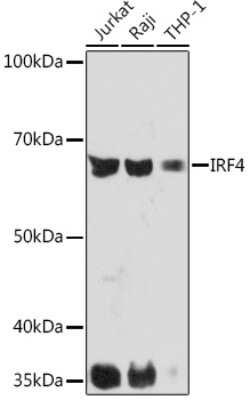 Western Blot: IRF4 Antibody (2U3G10) [NBP3-16591]