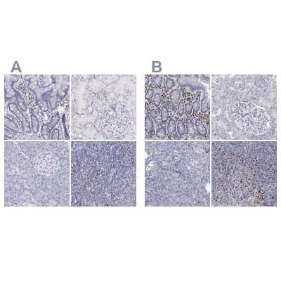 Immunohistochemistry-Paraffin: IRF4 Antibody [NBP1-82813]
