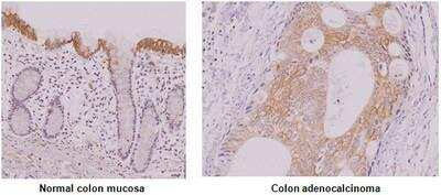 Immunohistochemistry-Paraffin: IRF5 Antibody (10T1) - BSA Free [NBP1-04307]