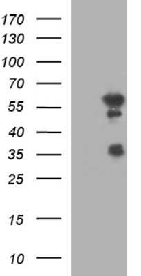 Western Blot: IRF5 Antibody (OTI1G7) [NBP2-45425]
