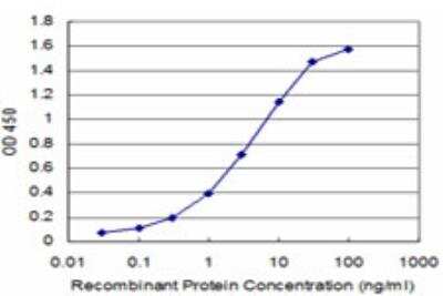 ELISA: IRF5 Antibody (1H6) [H00003663-M03]