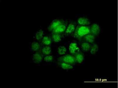 Immunocytochemistry/ Immunofluorescence: IRF5 Antibody (1H6) [H00003663-M03]