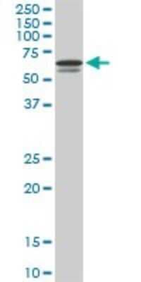 Western Blot: IRF5 Antibody (1H6) [H00003663-M03]
