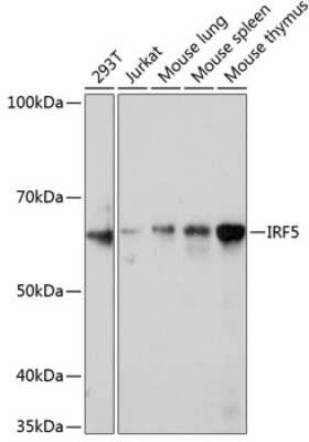 Western Blot: IRF5 Antibody (6L2B5) [NBP3-15343]
