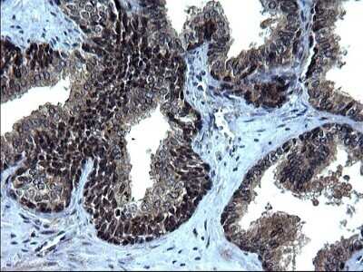 Immunohistochemistry: IRF5 Antibody (OTI1G7) - Azide and BSA Free [NBP2-71043]