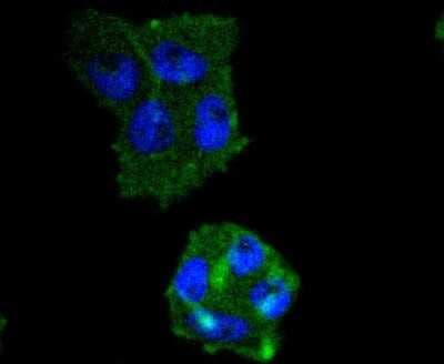Immunocytochemistry/ Immunofluorescence: IRF5 Antibody (SD203-07) [NBP2-67742]