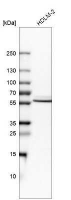 Western Blot: IRF5 Antibody [NBP2-14128]