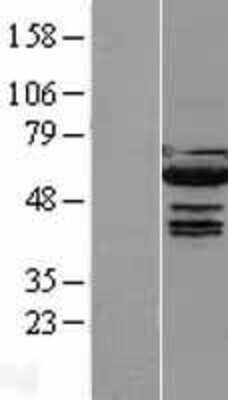 Western Blot: IRF5 Overexpression Lysate [NBL1-12034]