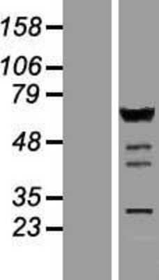 Western Blot: IRF5 Overexpression Lysate [NBP2-08321]
