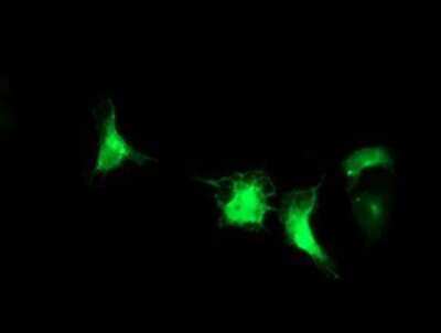 Immunocytochemistry/ Immunofluorescence: IRF6 Antibody (OTI2C10) [NBP2-00949]