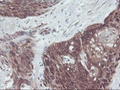 Immunohistochemistry-Paraffin: IRF6 Antibody (OTI2C10) [NBP2-00949]