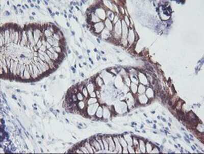 Immunohistochemistry-Paraffin: IRF6 Antibody (OTI2C10) [NBP2-00949]