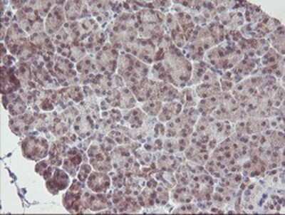 Immunohistochemistry-Paraffin: IRF6 Antibody (OTI2C10) [NBP2-00949]
