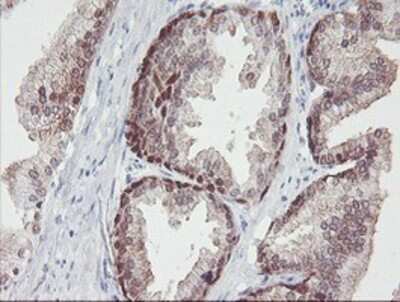Immunohistochemistry-Paraffin: IRF6 Antibody (OTI2C10) [NBP2-00949]
