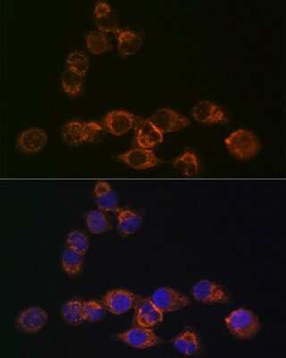 Immunocytochemistry/ Immunofluorescence: IRF6 Antibody (5D1Z4) [NBP3-16155]