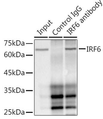 Immunoprecipitation: IRF6 Antibody (5D1Z4) [NBP3-16155]