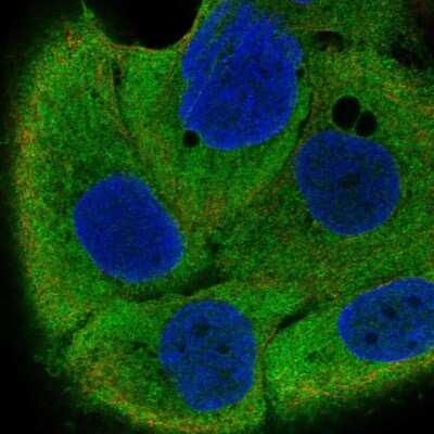 Immunocytochemistry/ Immunofluorescence: IRF6 Antibody [NBP2-55961]