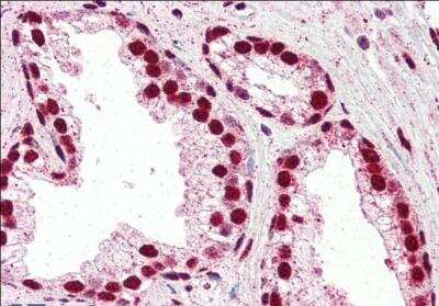 Immunohistochemistry-Paraffin: IRF6 Antibody [NBP1-51911]