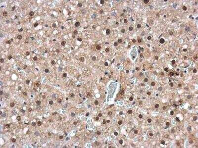 Immunohistochemistry-Paraffin: IRF6 Antibody [NBP2-16990]