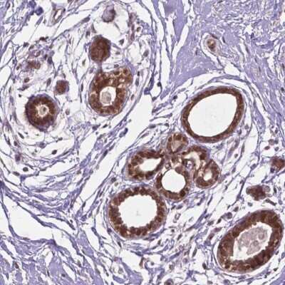Immunohistochemistry-Paraffin: IRF6 Antibody [NBP2-49383]