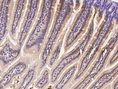 Immunohistochemistry-Paraffin: IRF6 Antibody [NBP2-98729]