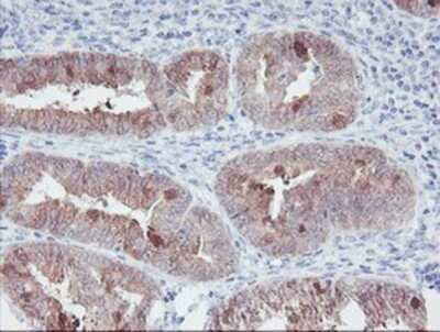Immunohistochemistry: IRF6 Antibody (OTI2C10) - Azide and BSA Free [NBP2-71044]