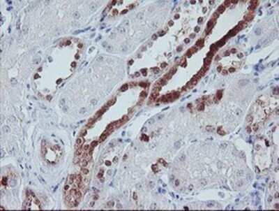 Immunohistochemistry: IRF6 Antibody (OTI2C10) - Azide and BSA Free [NBP2-71044]