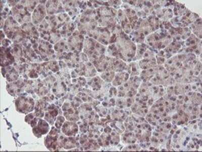 Immunohistochemistry: IRF6 Antibody (OTI2C10) - Azide and BSA Free [NBP2-71044]